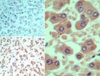 Immunohistochemistry-Paraffin: Smad3 Antibody [NB100-56479]