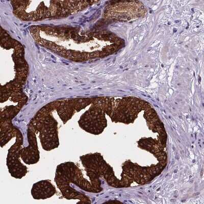 Immunohistochemistry-Paraffin: Smad3 Antibody [NBP2-57918]