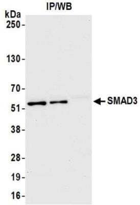 Immunoprecipitation: Smad3 Antibody (BLR144J) [NBP3-14724]