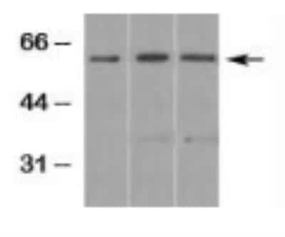 Western Blot: Smad3 Antibody [NB100-56479]