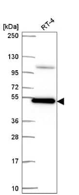 Western Blot: Smad3 Antibody [NBP2-57918]