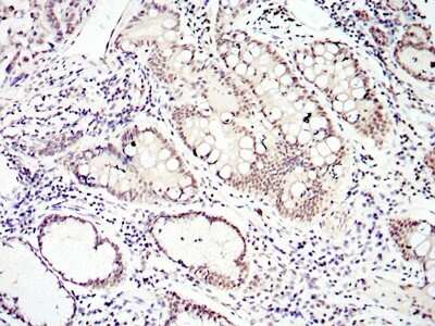 Immunohistochemistry-Paraffin: Smad4 Antibody (4G1C6) - BSA Free [NBP1-51646]