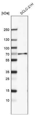 Western Blot: Smad4 Antibody (CL9774) [NBP3-05507]