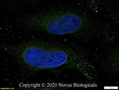Immunocytochemistry/ Immunofluorescence: Smad4 Antibody [NBP2-24951]