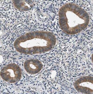 Immunohistochemistry-Paraffin: Smad4 Antibody [NBP1-84992]
