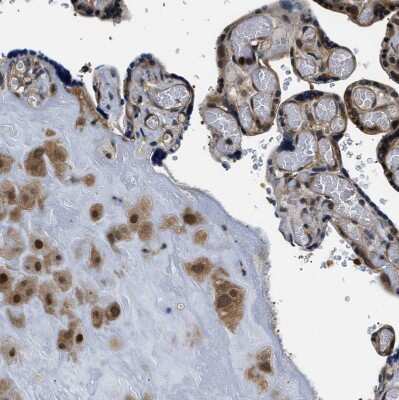 Immunohistochemistry-Paraffin: Smad4 Antibody [NBP1-84992]