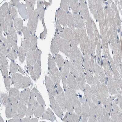 Immunohistochemistry-Paraffin: Smad4 Antibody [NBP1-84992]