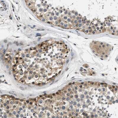 Immunohistochemistry-Paraffin: Smad4 Antibody [NBP1-84992]