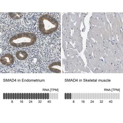 Immunohistochemistry-Paraffin: Smad4 Antibody [NBP1-84992]