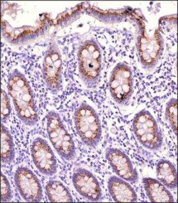 Immunohistochemistry-Paraffin: Smad4 Antibody [NBP2-24951]