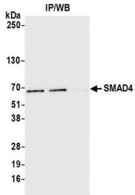 Immunoprecipitation: Smad4 Antibody (BLR133J) [NBP3-14714]