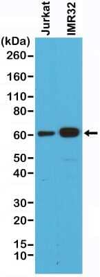 Western Blot: Smad4 Antibody (RM277) [NBP2-61587]