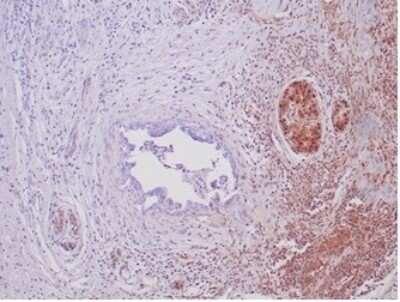 Immunohistochemistry-Paraffin: Smad4 Antibody (SMAD/6309R) [NBP3-13963]