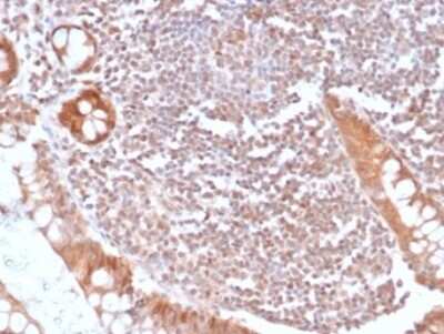 Immunohistochemistry-Paraffin: Smad4 Antibody (SMAD/6309R) [NBP3-13963]