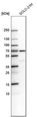 Western Blot: 0 [NBP1-84992]