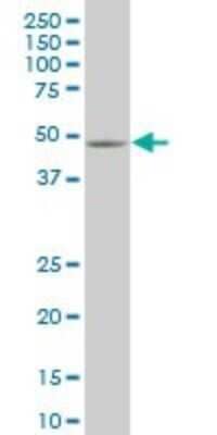 Western Blot: Smad5 Antibody (1C1) [H00004090-M11]