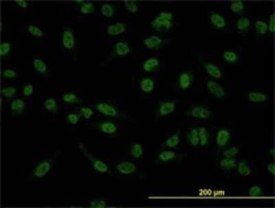 Immunocytochemistry/ Immunofluorescence: Smad5 Antibody (2D7) [H00004090-M01]