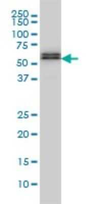 Western Blot: Smad5 Antibody (2D7) [H00004090-M01]