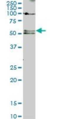 Western Blot: Smad5 Antibody (2D7) [H00004090-M01]