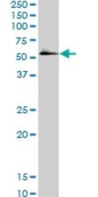 Western Blot: Smad5 Antibody (2D7) [H00004090-M01]