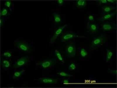 Immunocytochemistry/ Immunofluorescence: Smad5 Antibody (3A10) [H00004090-M03]