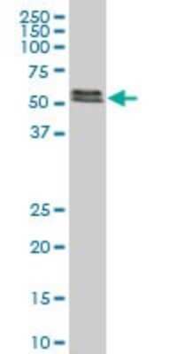 Western Blot: Smad5 Antibody (3A10) [H00004090-M03]