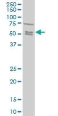 Western Blot: Smad5 Antibody (4F10) [H00004090-M05]