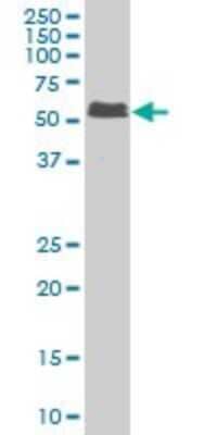 Western Blot: Smad5 Antibody (5E12) [H00004090-M08]