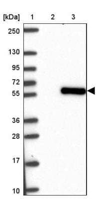 Western Blot: Smad5 Antibody [NBP2-32406]