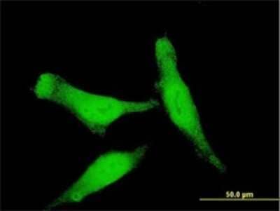 Immunocytochemistry/ Immunofluorescence: Smad7 Antibody (3G8) [H00004092-M01]