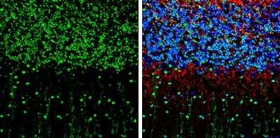Immunohistochemistry-Frozen: Smad7 Antibody [NBP3-13375]