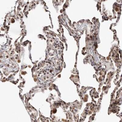 Immunohistochemistry-Paraffin: Smad7 Antibody [NBP1-87728]