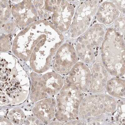 Immunohistochemistry-Paraffin: Smad7 Antibody [NBP1-87728]