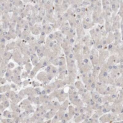 Immunohistochemistry-Paraffin: Smad7 Antibody [NBP1-87728]
