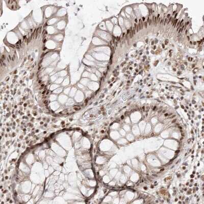 Immunohistochemistry-Paraffin: Smad7 Antibody [NBP1-87728]