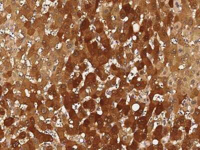 Immunohistochemistry-Paraffin: Smad7 Antibody [NBP2-98971]