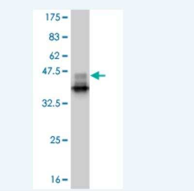 Western Blot: Smad9 Antibody (1B5) [H00004093-M03]