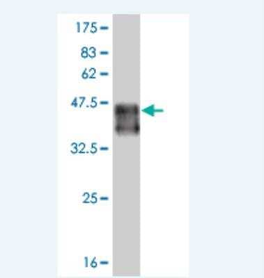 Western Blot: Smad9 Antibody (3E5) [H00004093-M02]