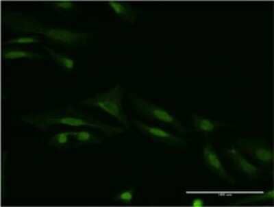 Immunocytochemistry/ Immunofluorescence: Smad9 Antibody (3H2) [H00004093-M05]