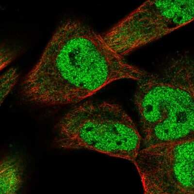 Immunocytochemistry/ Immunofluorescence: Smad9 Antibody [NBP2-38176]