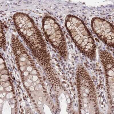 Immunohistochemistry-Paraffin: Smad9 Antibody [NBP2-38176]