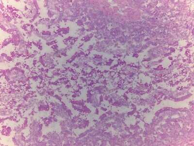 Hematoxylin & Eosin Stain: Small Intestine Tissue Slides (Adult Normal)- Frozen [NBP2-77558]