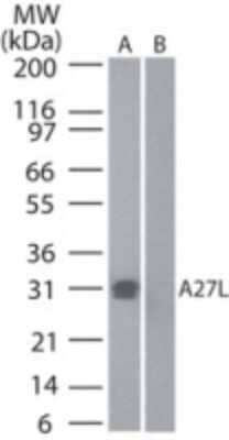 Western Blot: Smallpox A27L Antibody [NB100-56486]