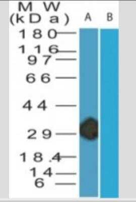 Western Blot: Smallpox B5R Antibody (1J2F3)Azide Free [NBP2-33255]