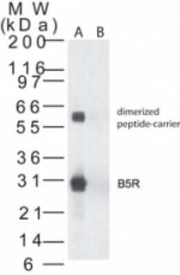 Western Blot: Smallpox B5R Antibody [NB100-56453]