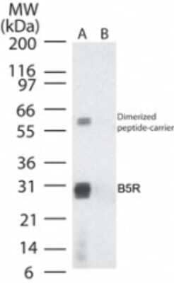 Western Blot: Smallpox B5R Antibody [NB100-56454]