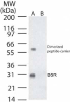 Western Blot: Smallpox B5R Antibody [NB100-56455]