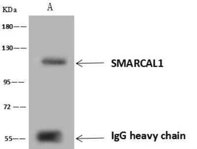 Immunoprecipitation: SmarcAL1 Antibody [NBP3-12599]