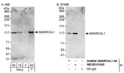 Western Blot: SmarcAL1 Antibody [NB100-81640]