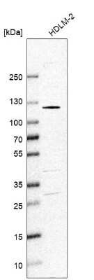 Western Blot: SmarcAL1 Antibody [NBP2-13352]